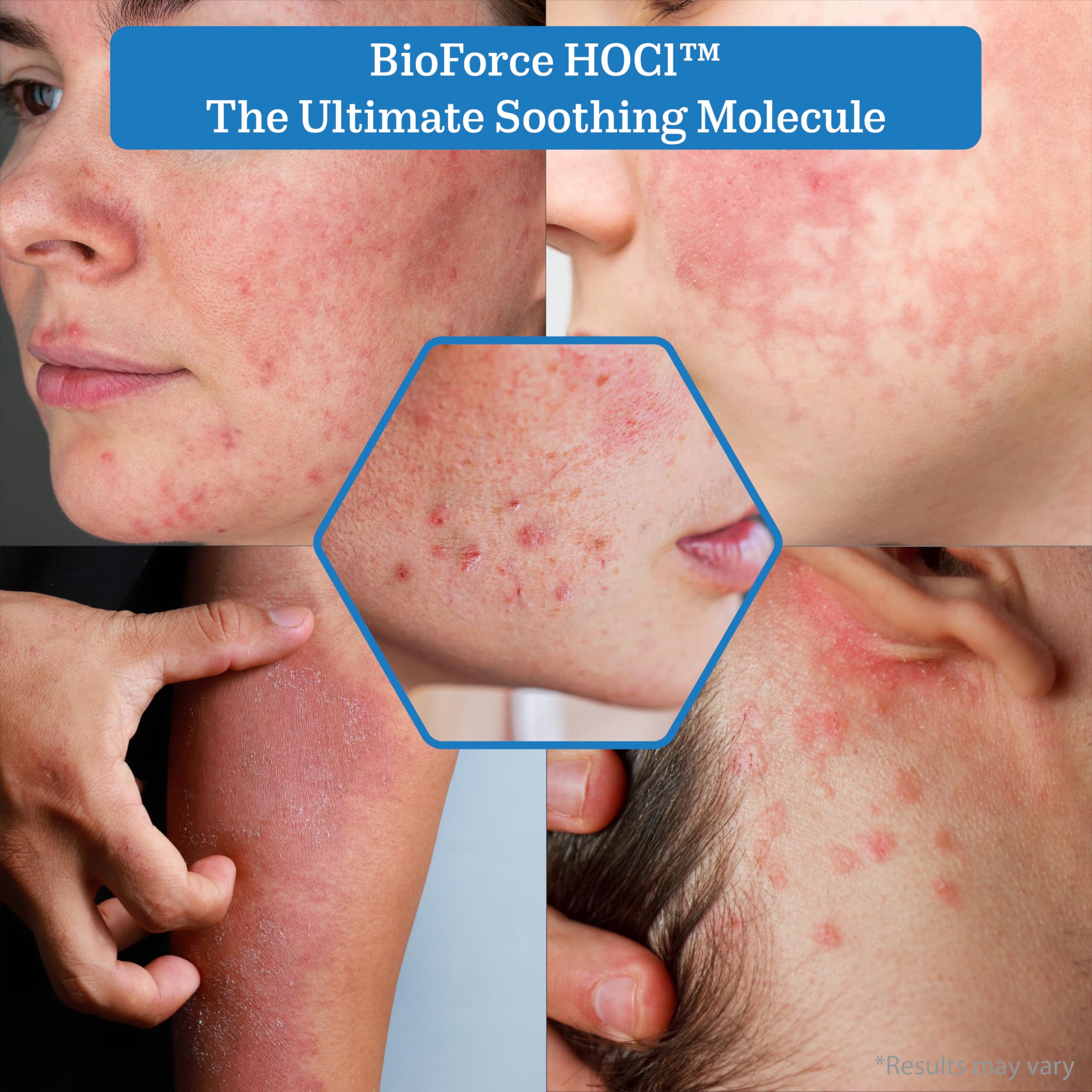 NueVue BioForce HOCl purified-water ingredients close-up illustrates a clean formulation.
