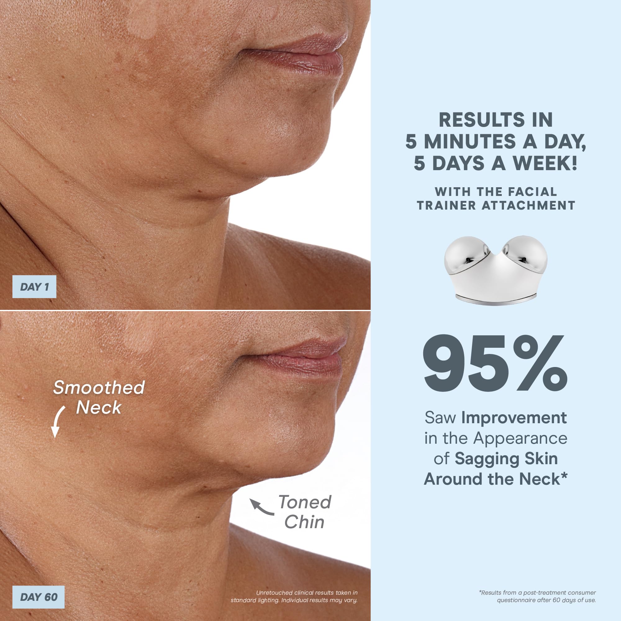 NuFACE Aqua Gel hydrates skin for up to 24 hours during microcurrent sessions.