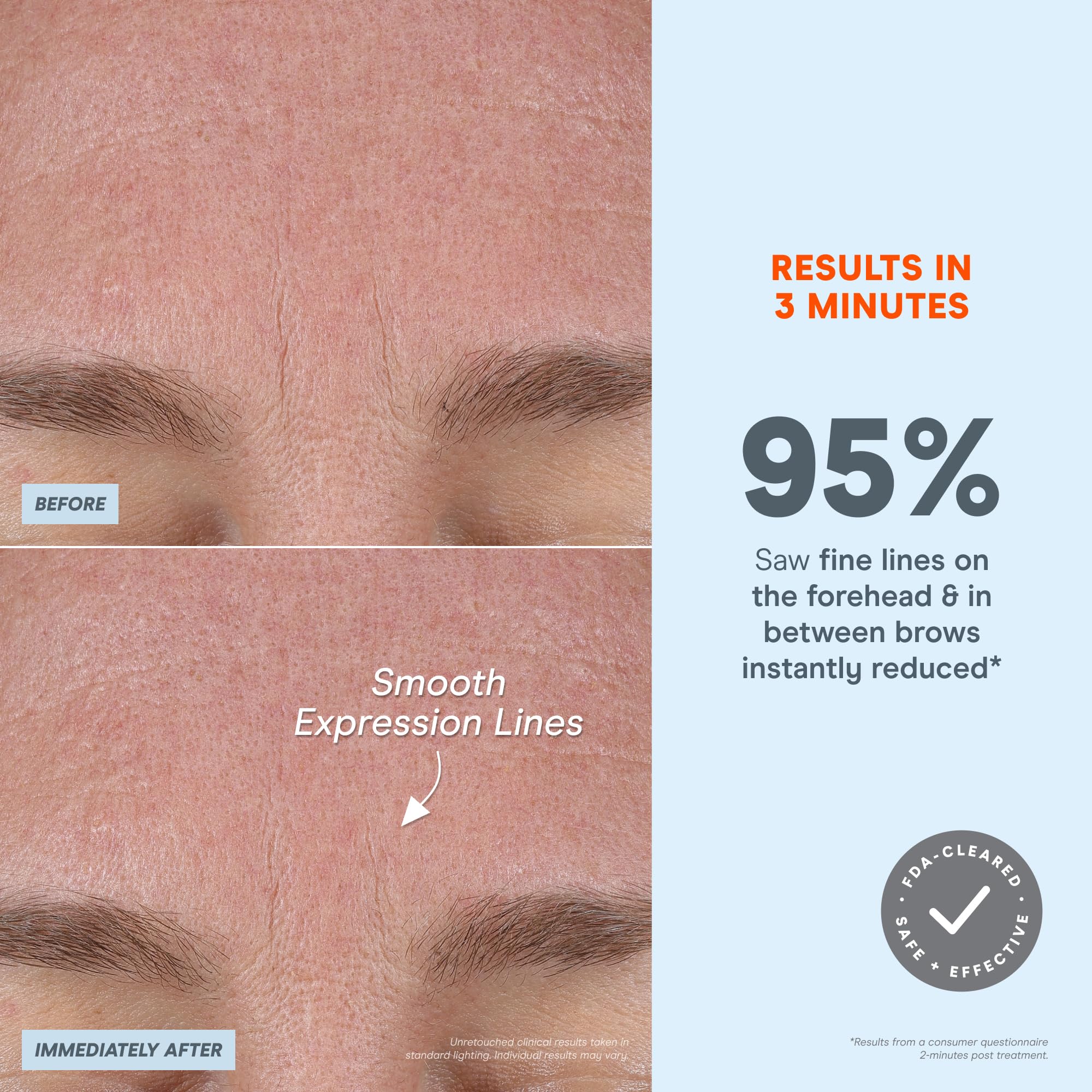 NuFACE FIX LED indicators guide intensity for eyes, lips, and lines.