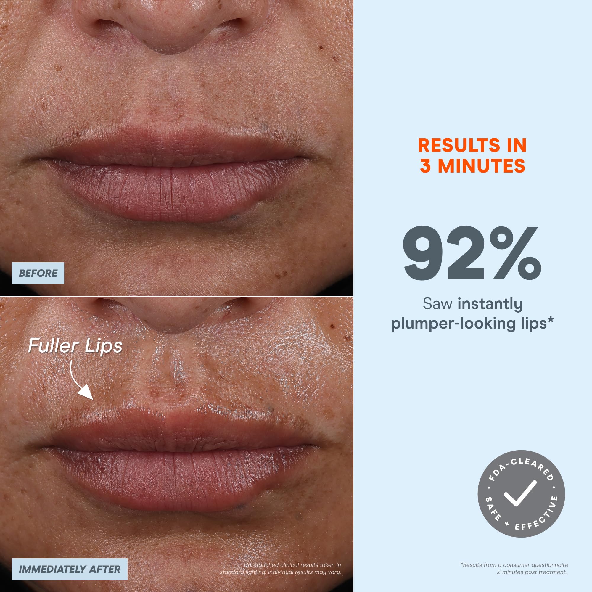 NuFACE FIX travel-friendly design makes on-the-go microcurrent treatments easy.
