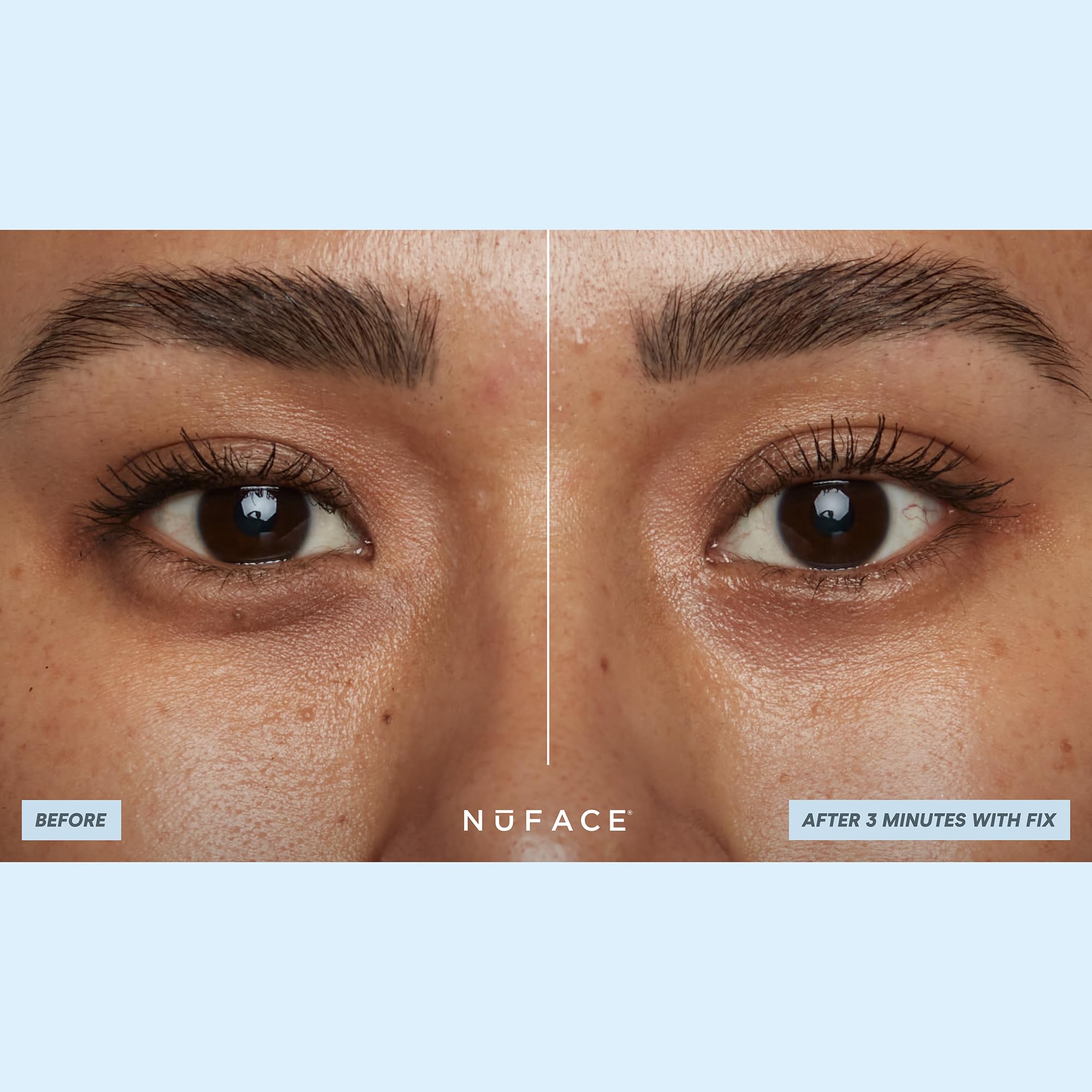 NuFACE IonPlex arginine smoothing supports gentle-looking line refinement around the eyes.