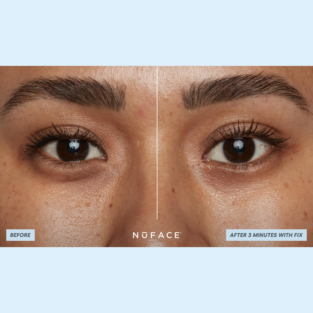 NuFACE IonPlex arginine smoothing supports gentle-looking line refinement around the eyes.