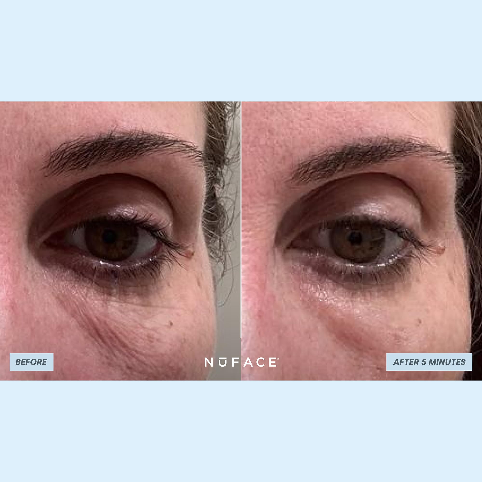 NuFACE IonPlex hydration-lock patch seals moisture for a healthy glow.