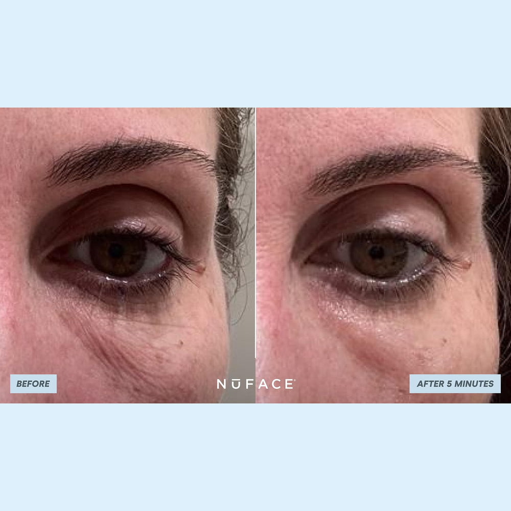 NuFACE IonPlex hydration-lock patch seals moisture for a healthy glow.