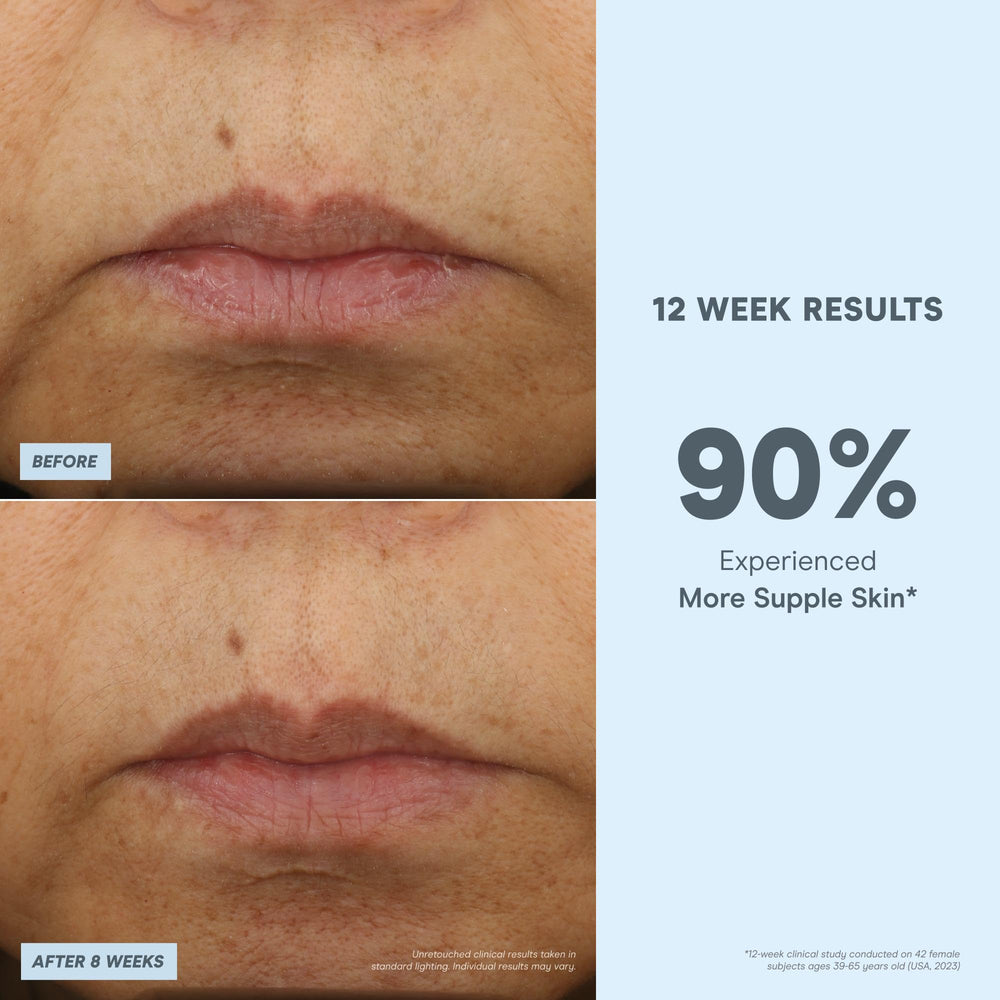 NuFACE Peony root extract graphic, signaling botanicals that support hydration and glow.
