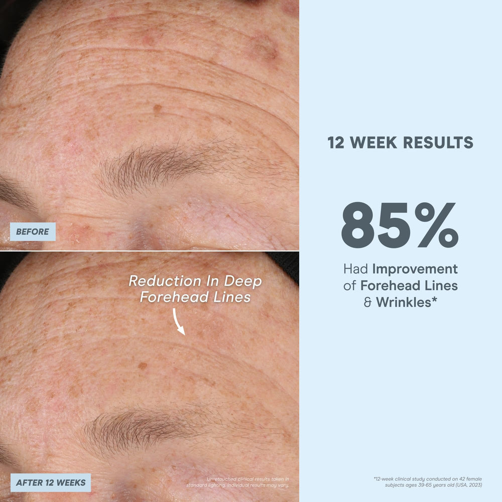 NuFACE Super Peptide Booster packaging, clean design and fragrance-free formula for sensitive skin.