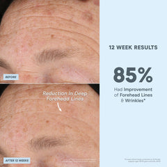 NuFACE Super Peptide Booster packaging, clean design and fragrance-free formula for sensitive skin.