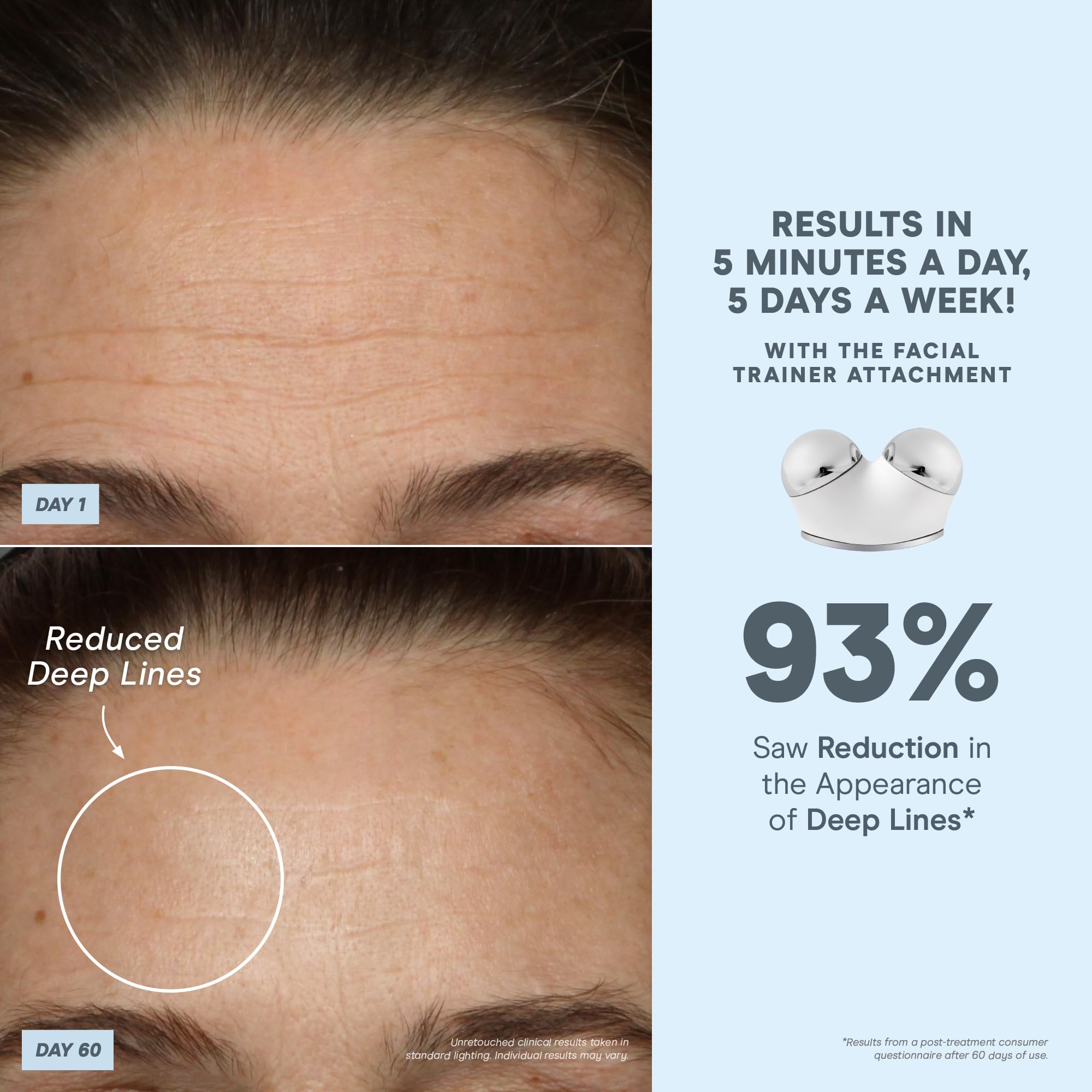 NuFACE app interface on smartphone with guided treatments