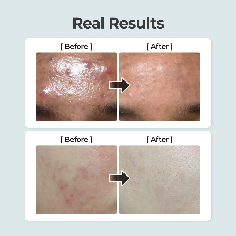 Numbuzin No.1 Toner packaging front fragrance-free formula for sensitive skin.
