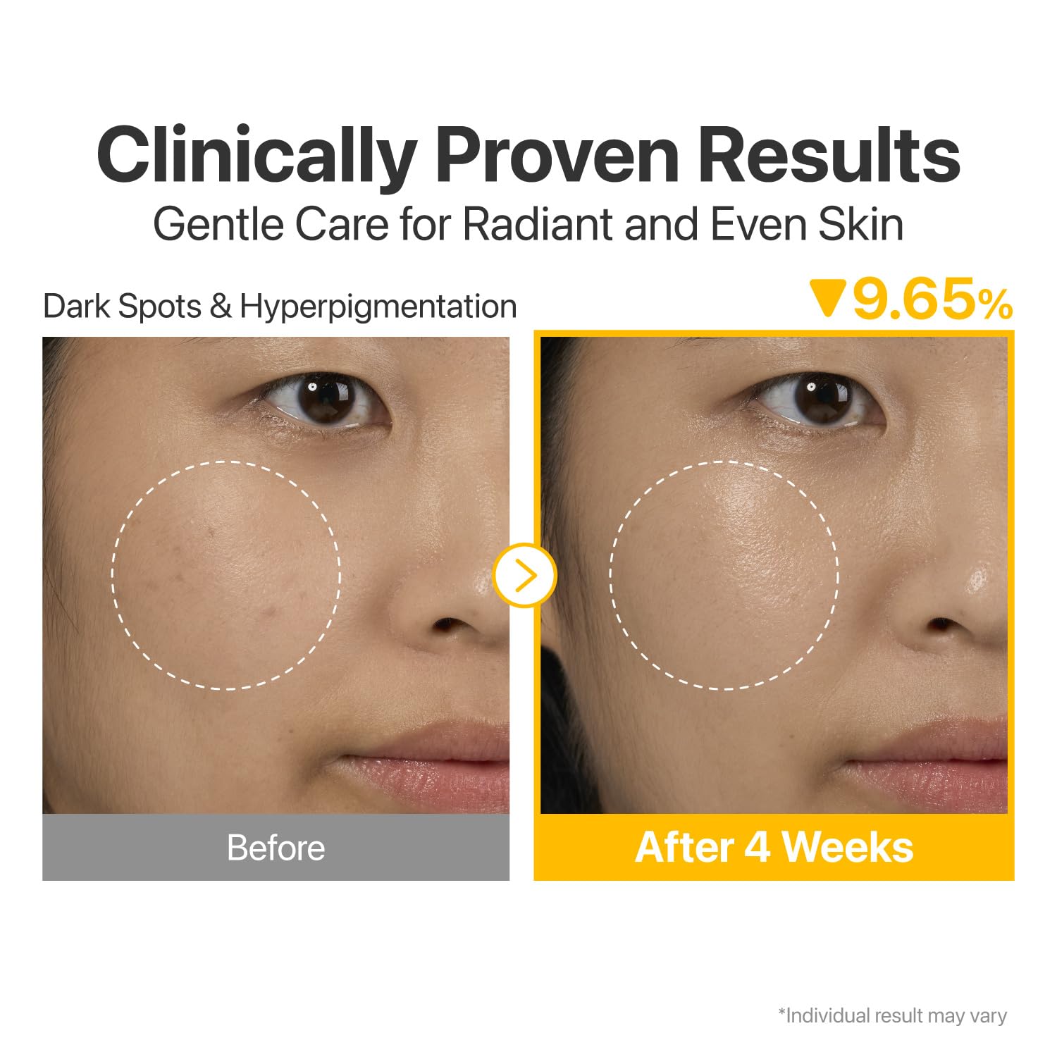 numbuzin No5 Serum application on hand highlights easy layering