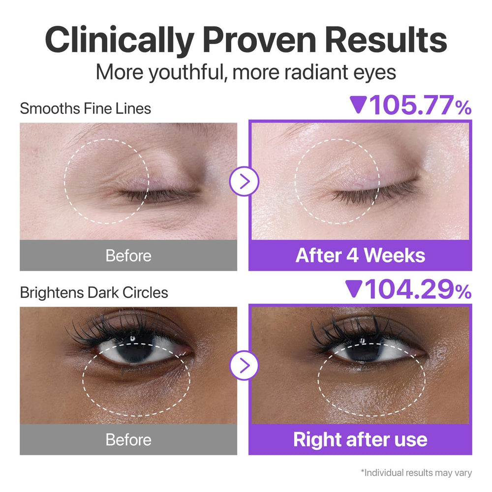 Numbuzin No.9 depuffing formula helps reduce under-eye puffiness