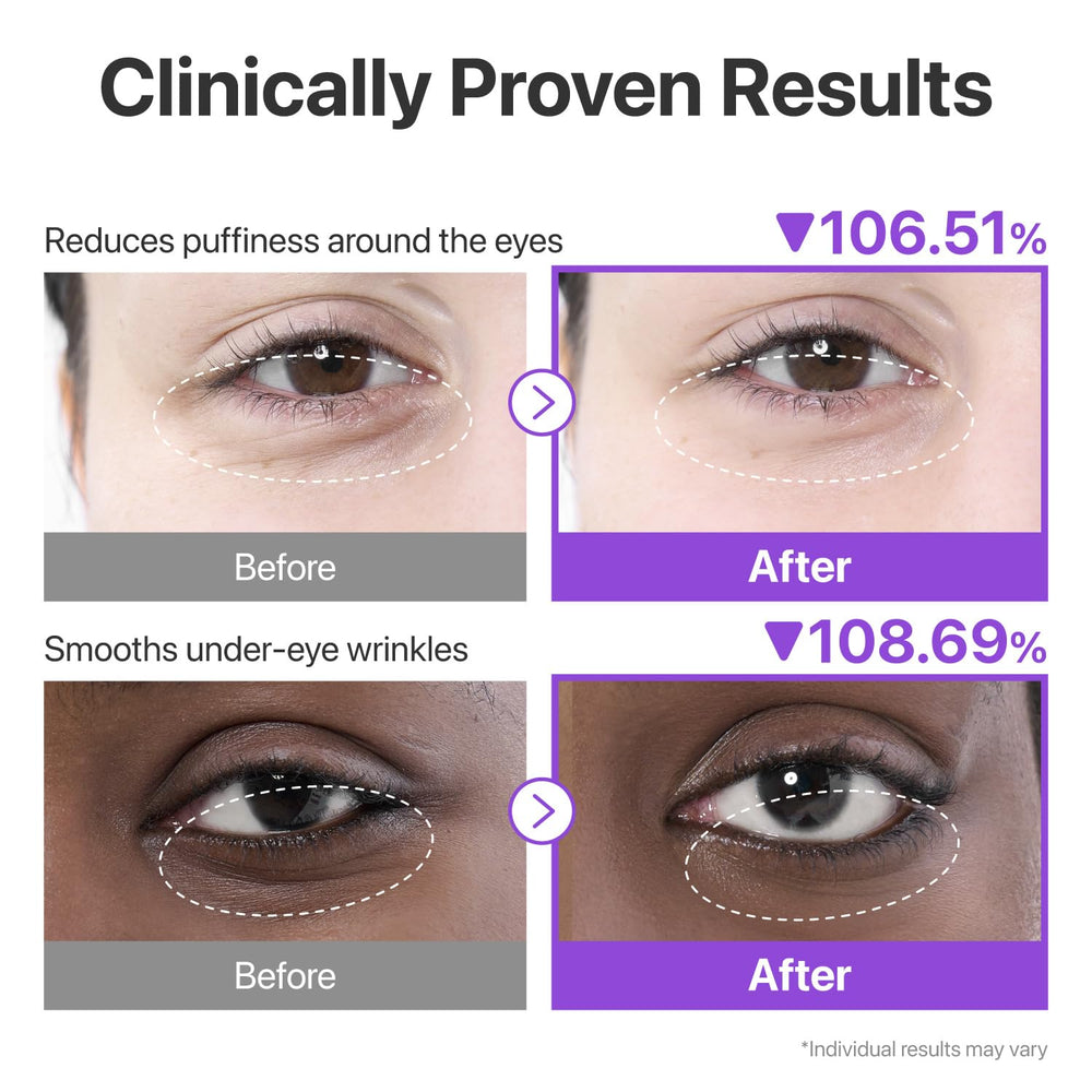 numbuzin No.9 Eye Patches patches on hand demonstrate flexible hydrogel consistency.