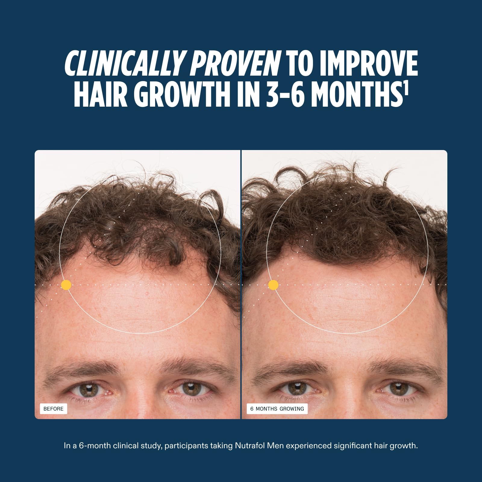 Man adding Nutrafol capsules to morning routine for consistent hair support
