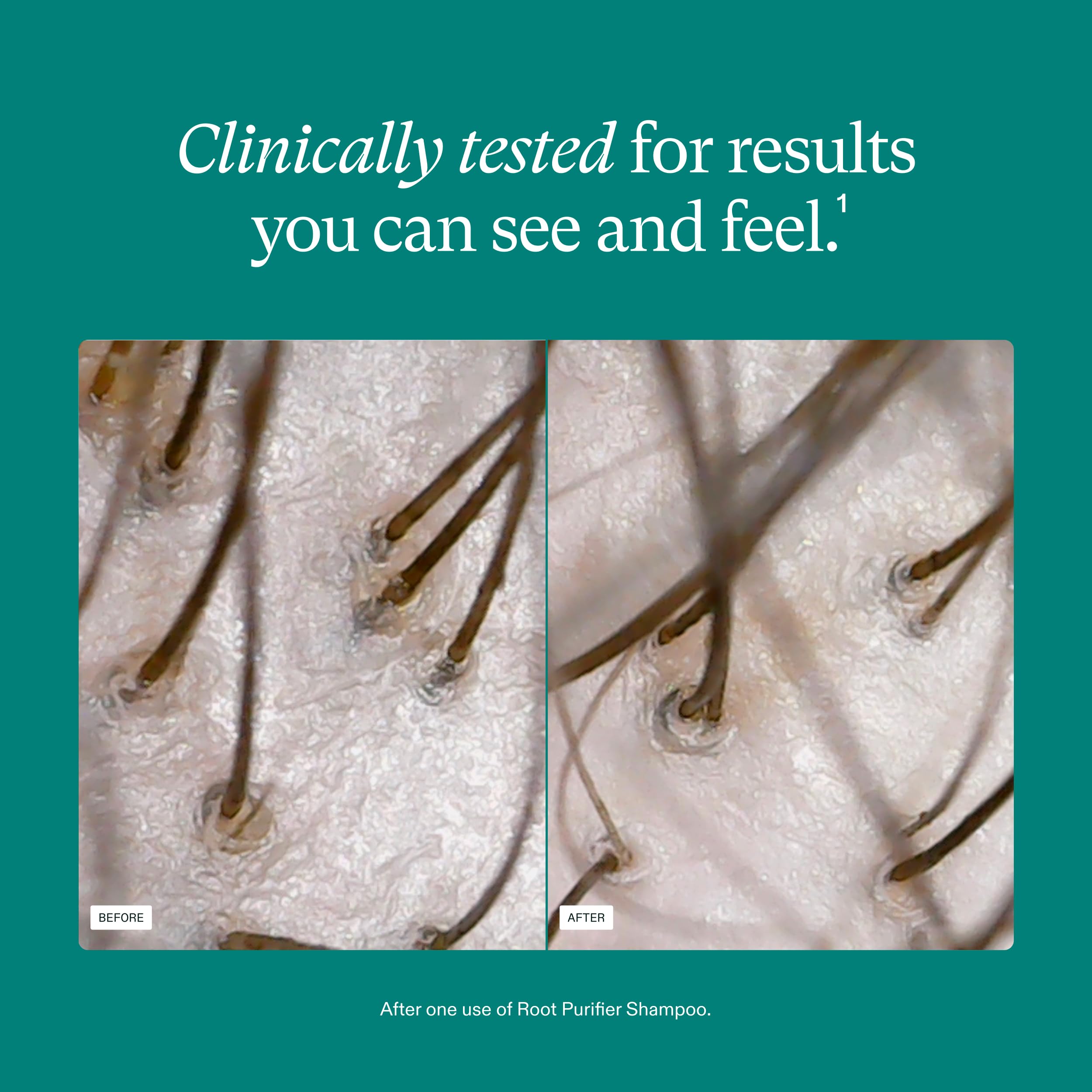 Nutrafol shampoo being applied in shower, illustrates gentle cleansing and oil removal