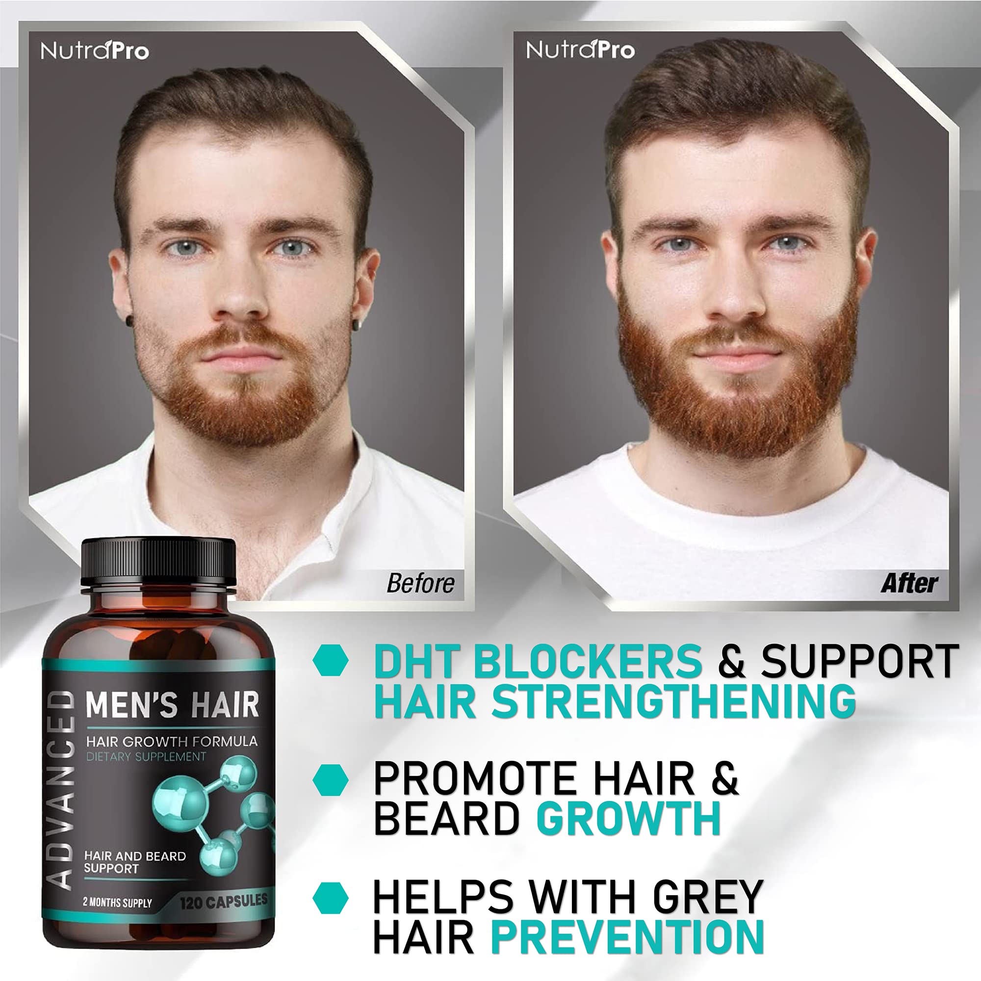 NutraPro crown thinning visual suggests targeted support for thinning areas.