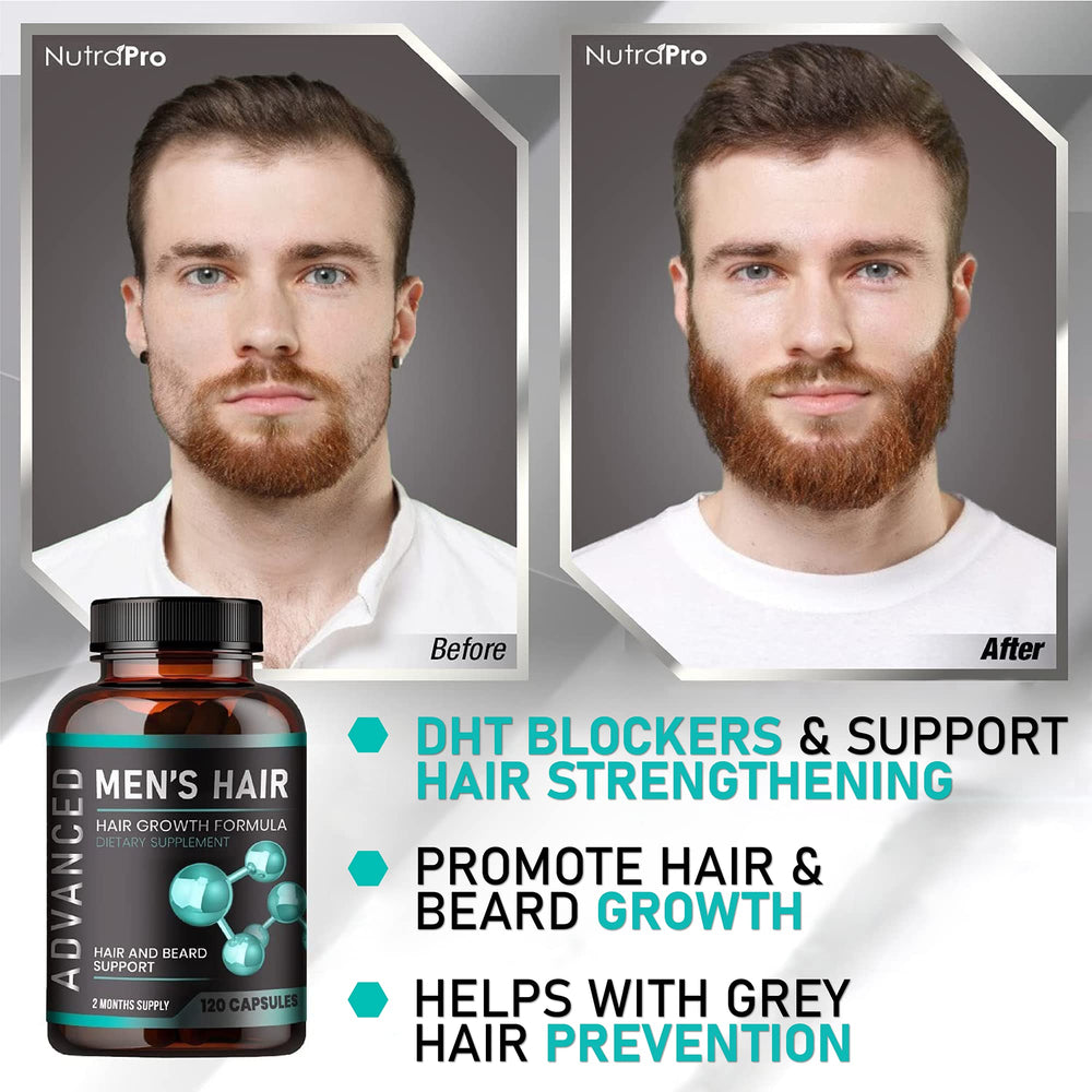NutraPro crown thinning visual suggests targeted support for thinning areas.