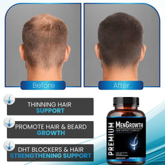 NutraPro MenGrowth ingredients blend featuring biotin and saw palmetto