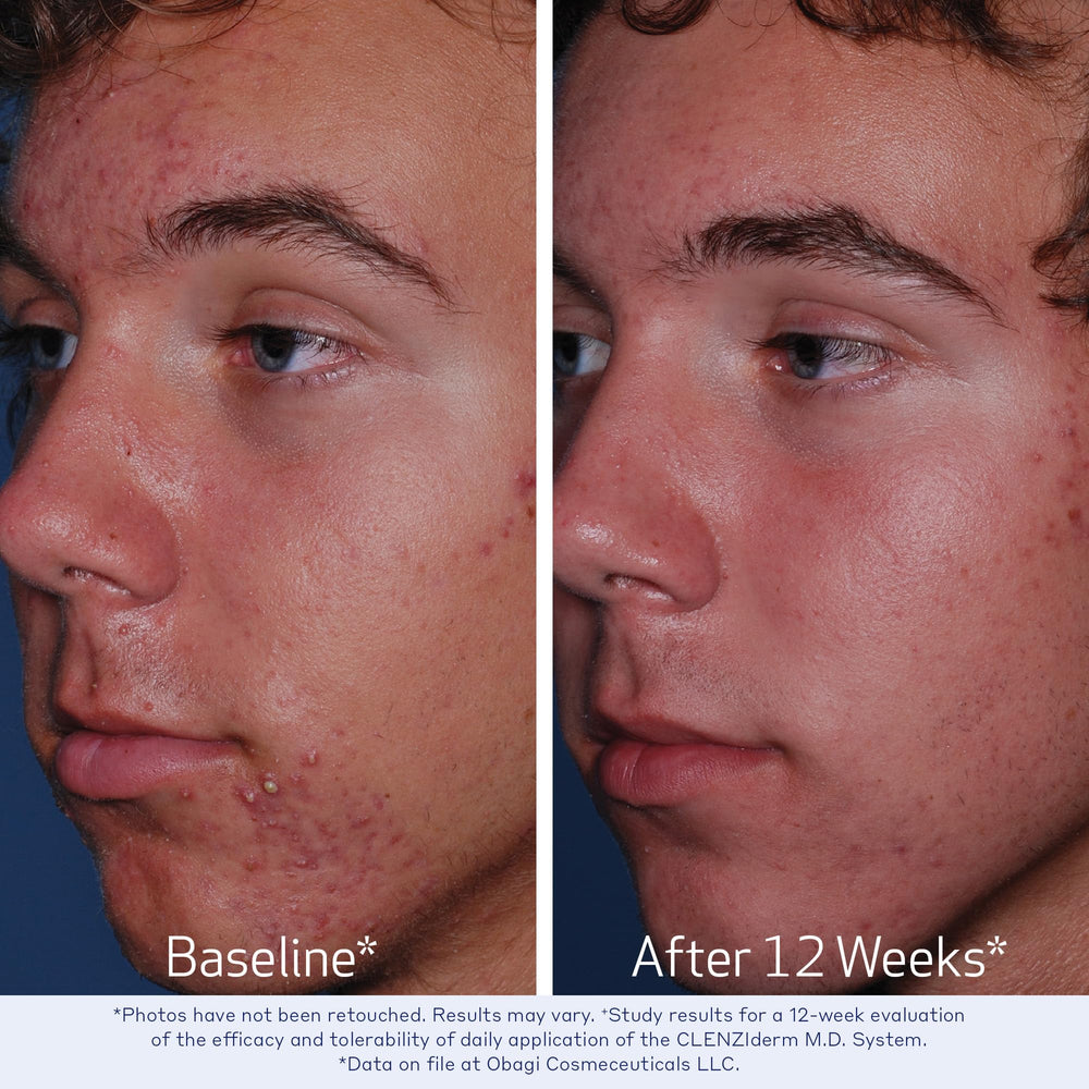 Label highlights 2% salicylic acid in Obagi cleanser