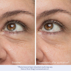 Obagi Daily Hydro-Drops smooths puffiness around the eyes.