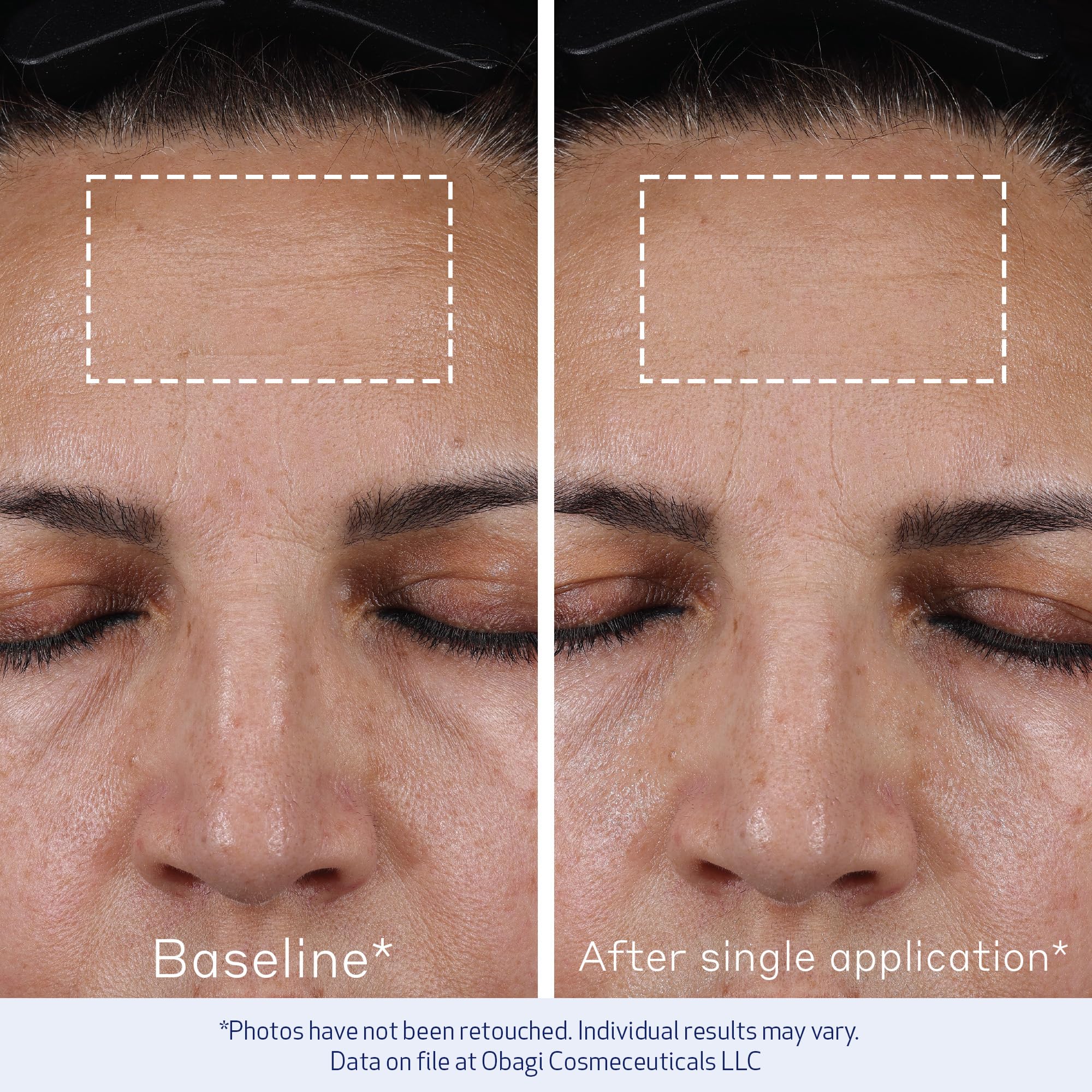 Obagi ELASTIderm Advanced Filler packaging communicates brand quality and tips.