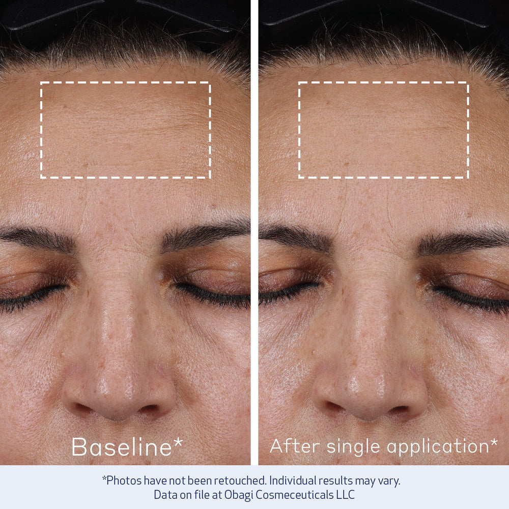 Obagi ELASTIderm Advanced Filler packaging communicates brand quality and tips.