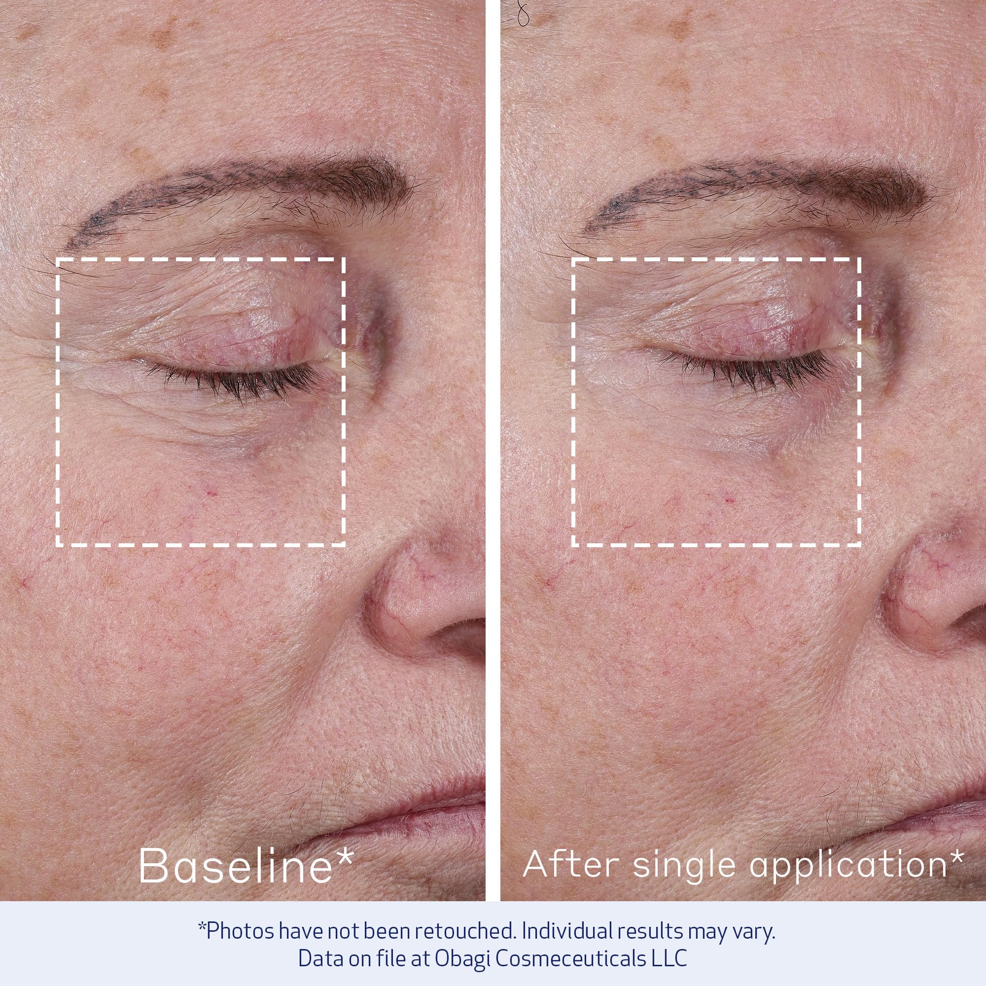Obagi ELASTIderm Advanced Filler texture swirl highlights peptide-rich formula.