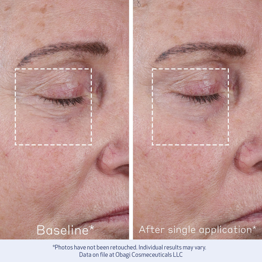 Obagi ELASTIderm Advanced Filler texture swirl highlights peptide-rich formula.