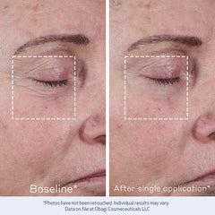 Obagi ELASTIderm Advanced Filler texture swirl highlights peptide-rich formula.