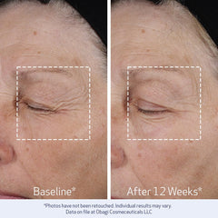 Obagi ELASTIderm Bi-Mineral Contour Complex ingredient highlight on packaging.