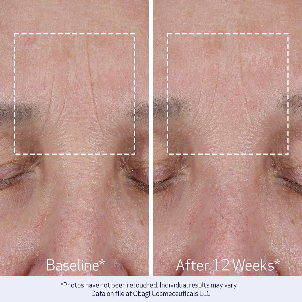 Obagi ELASTIderm clinical results graph illustrating fine-line improvements.