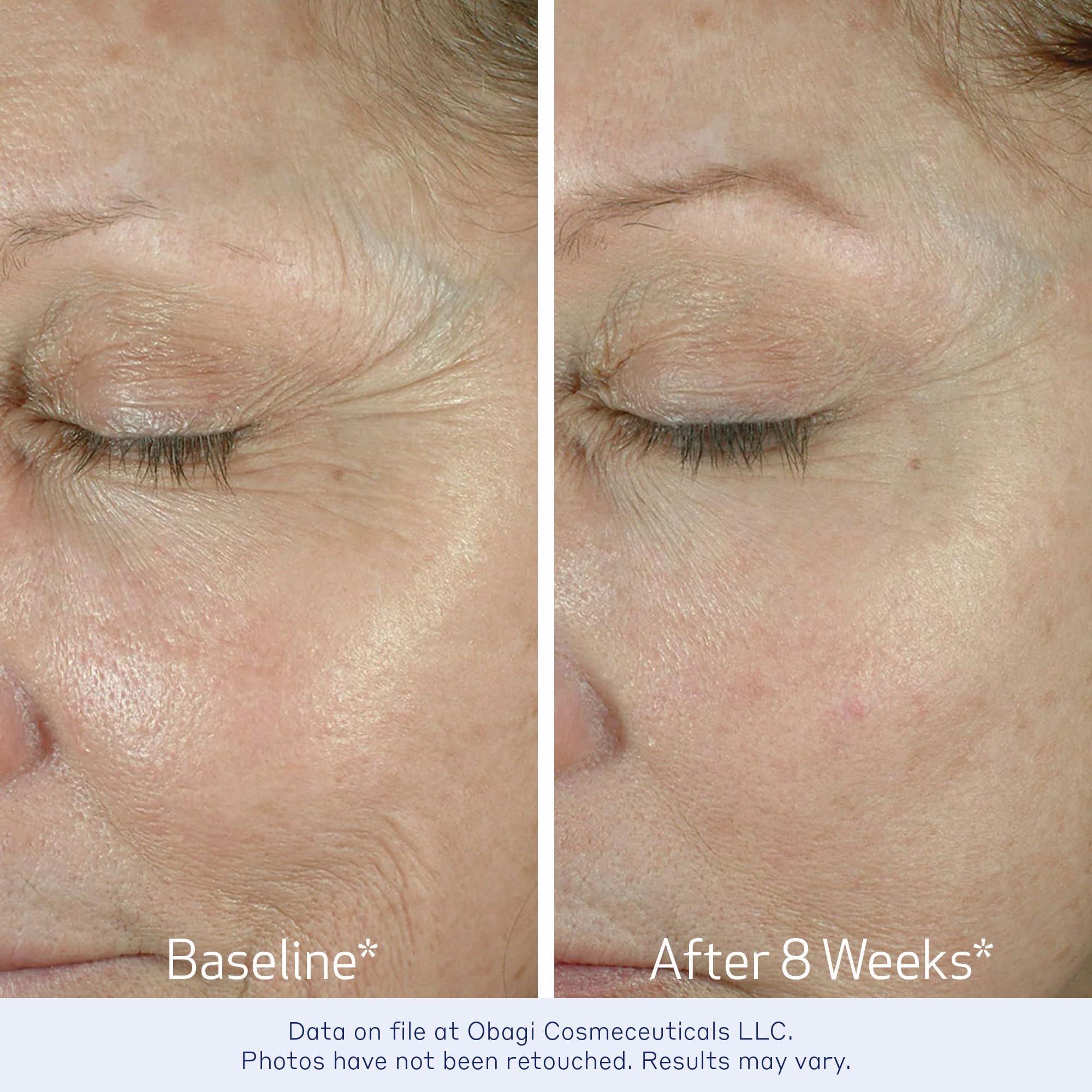 Obagi ELASTIderm Eye Cream texture swirl demonstrates a gentle, non-greasy feel that nourishes the eye area.