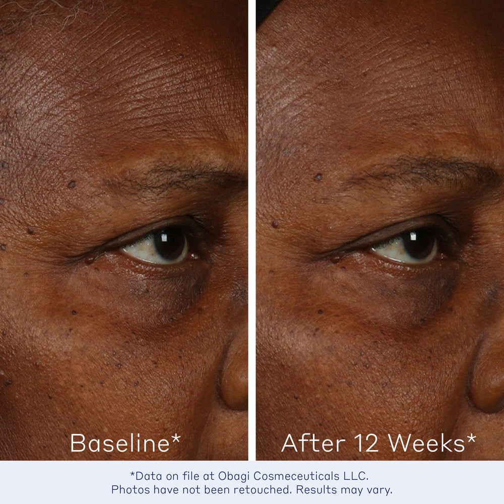Obagi ELASTIderm Serum clinical-results chart shows reported firmness and elasticity.