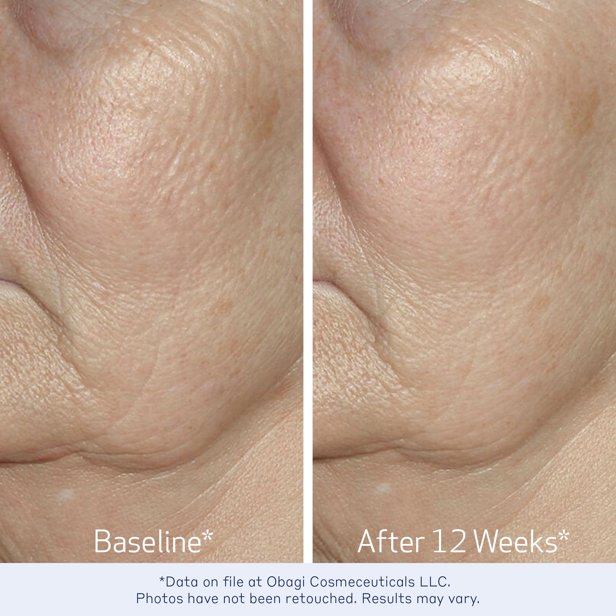Obagi ELASTIderm Serum dermatologist-tested badge signals professional validation for skincare.