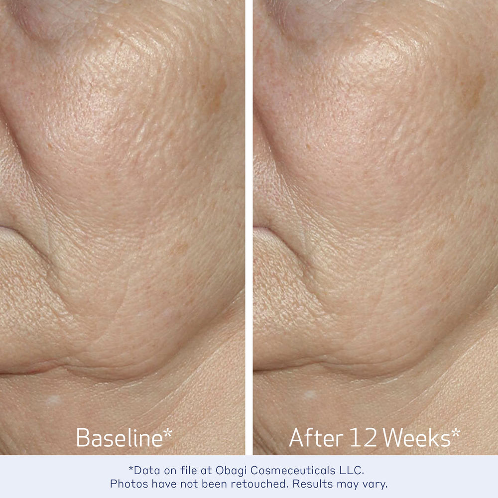Obagi ELASTIderm Serum dermatologist-tested badge signals professional validation for skincare.