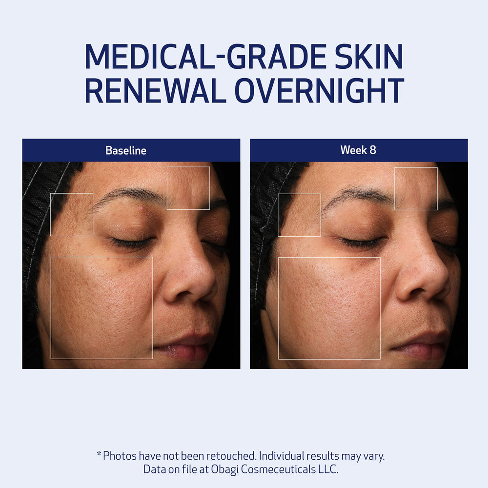 Label close-up of Obagi Medical Retinol + PHA night cream, ready for nightly application.