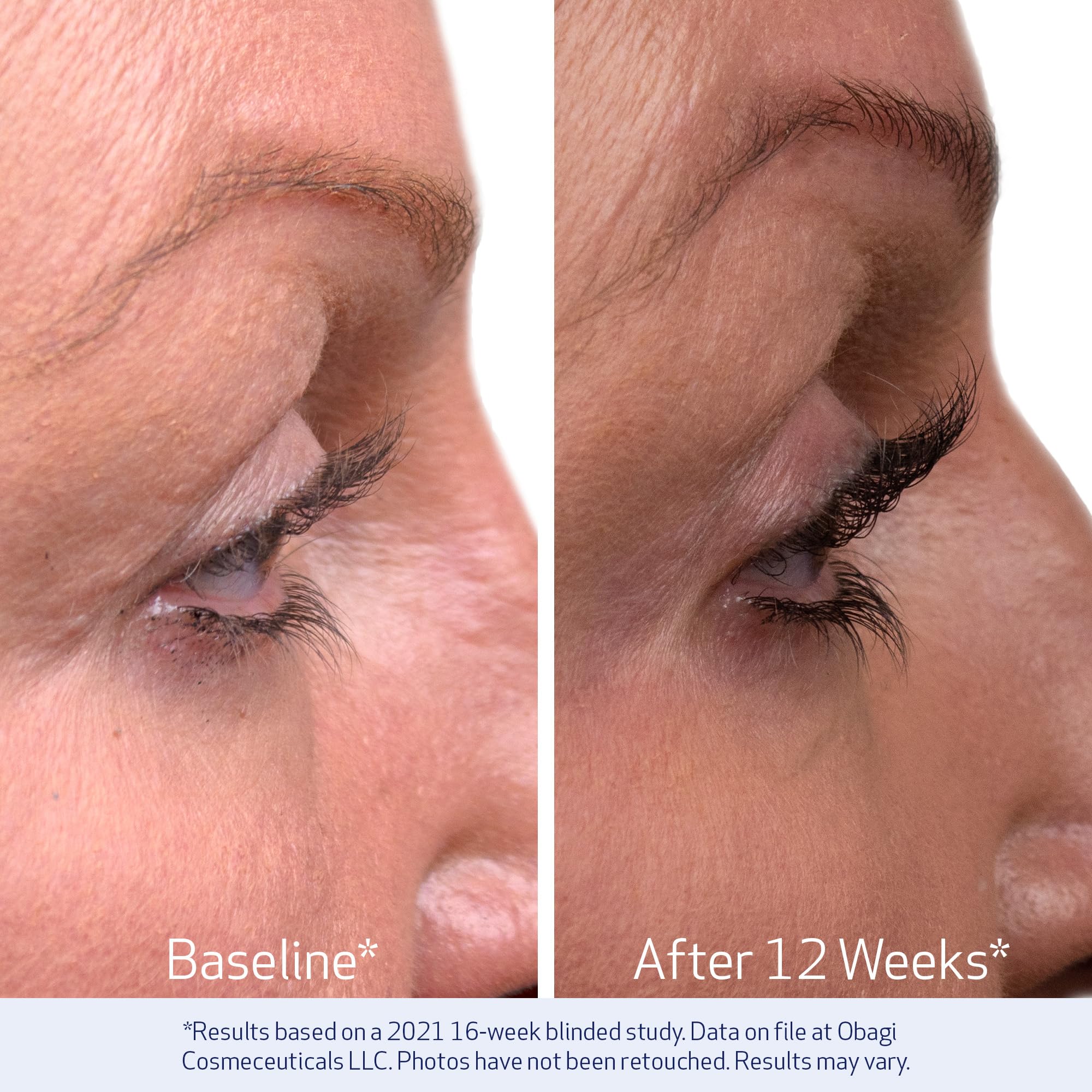 Obagi Nu-Cil applicator tip closeup emphasizes safe, targeted lash tip application