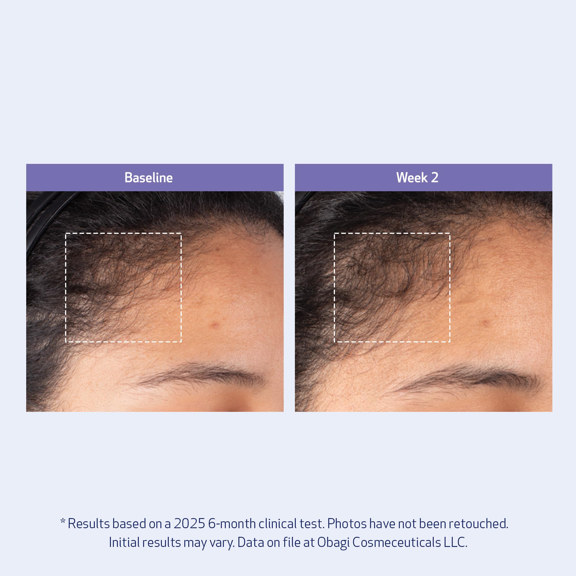 Obagi Nu-Cil BioStim serum label close-up emphasizes Biotin and peptide blend.
