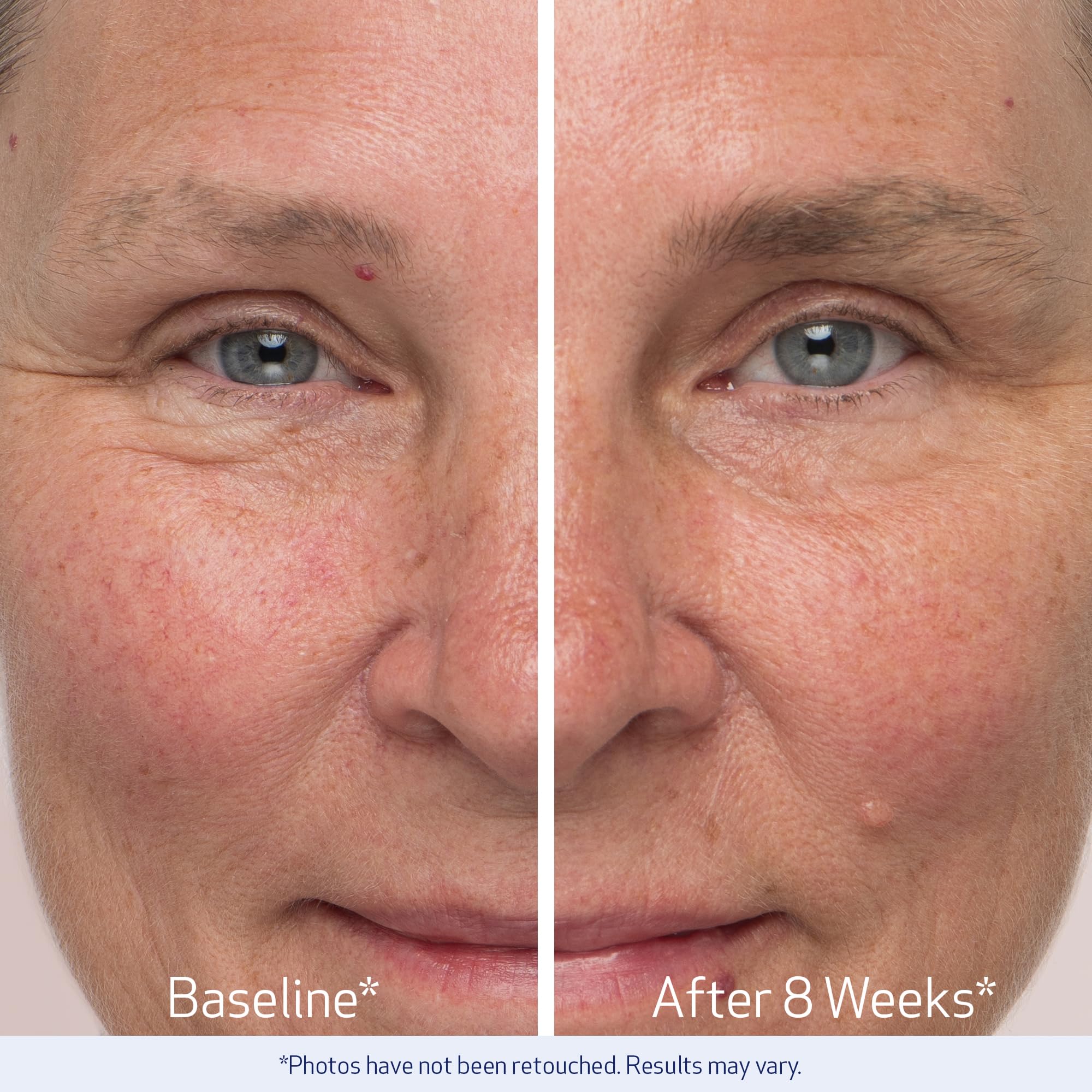 Obagi Nu-Cil eyebrow density closeup highlights brow fullness gain