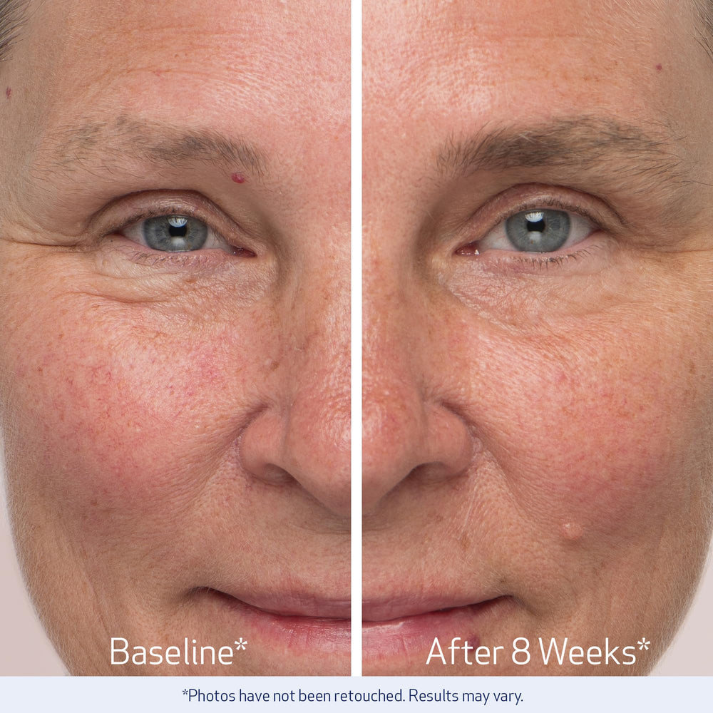 Obagi Nu-Cil eyebrow density closeup highlights brow fullness gain