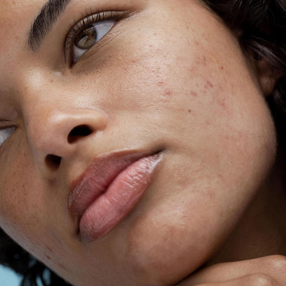 Obagi Rebalance cream ingredients highlight ceramides and niacinamide.