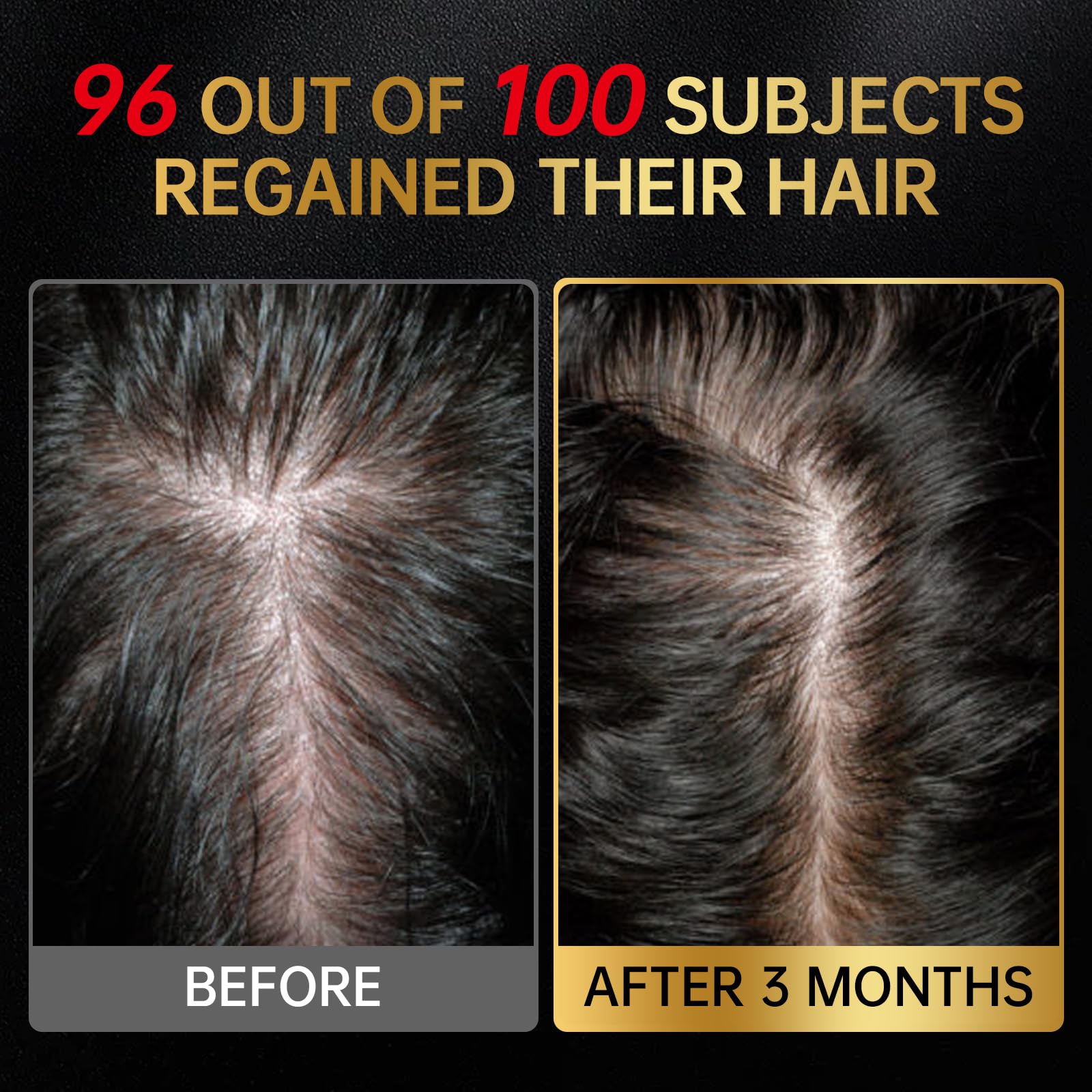 OCSINL Minoxidil with biotin emphasizes hair strength and nourishment