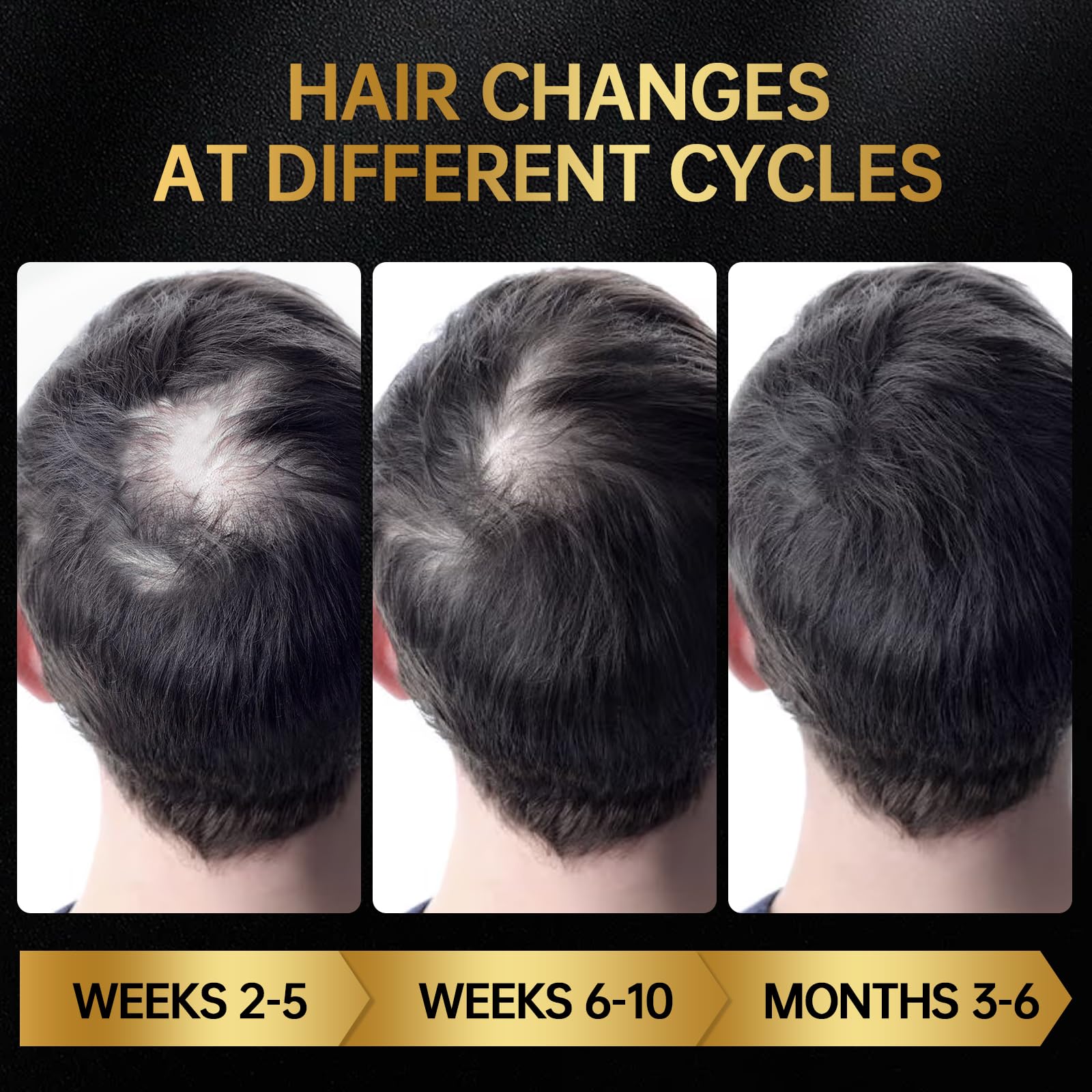 OCSINL Minoxidil non-greasy formula keeps scalp comfortable