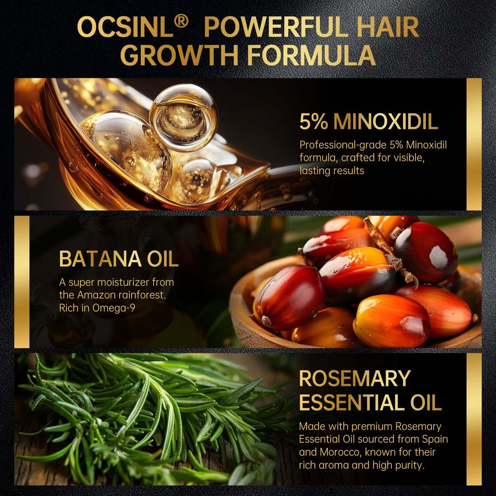 OCSINL Minoxidil rosemary oil image highlights soothing botanical ingredients
