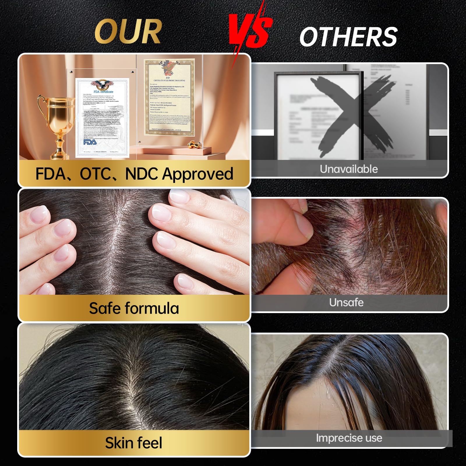 OCSINL Minoxidil for men and women used in daily routine