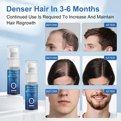 OCVWJKD scalp massage shows absorption during thinning area treatment.
