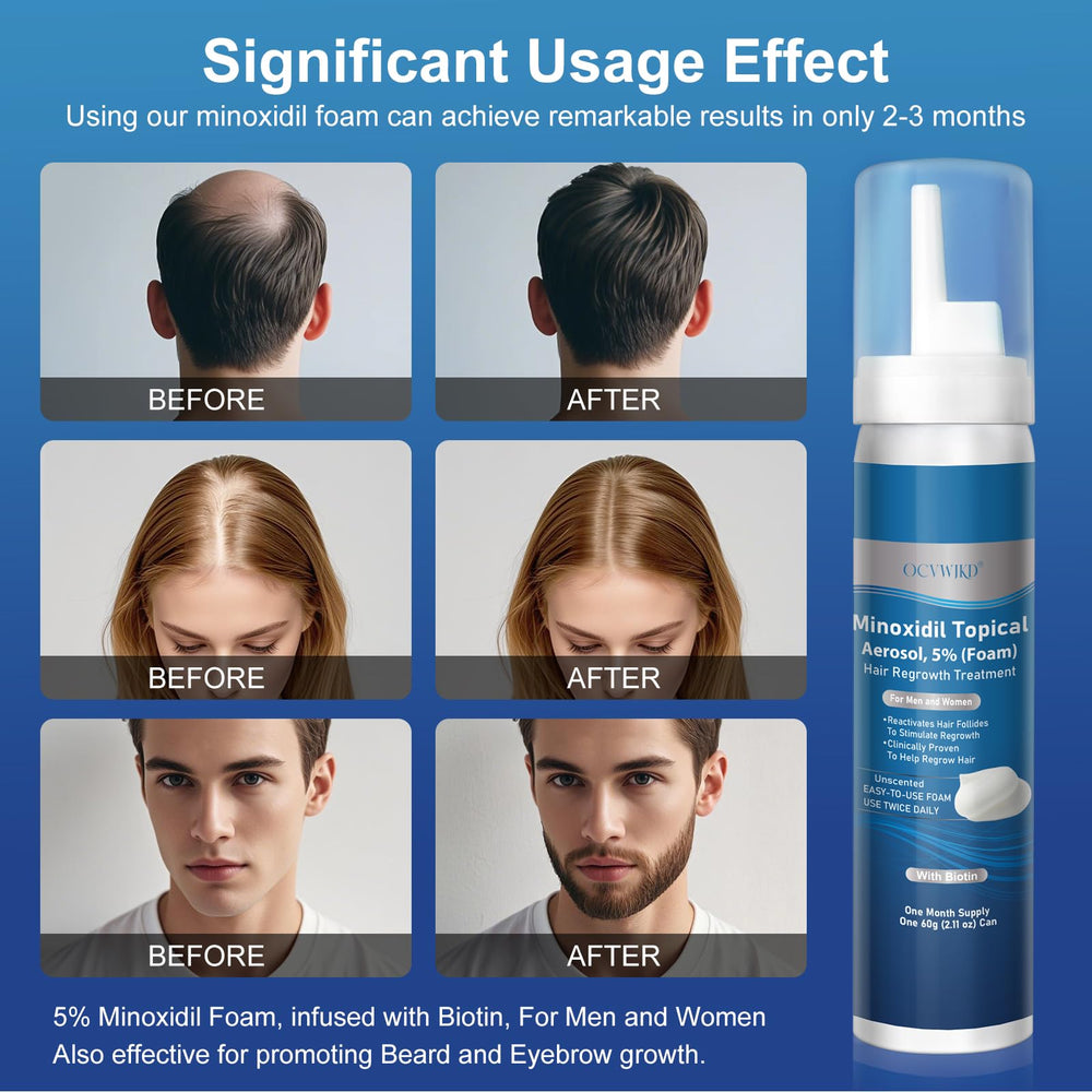 OCVWJKD unisex hair growth foam used for thicker hair.