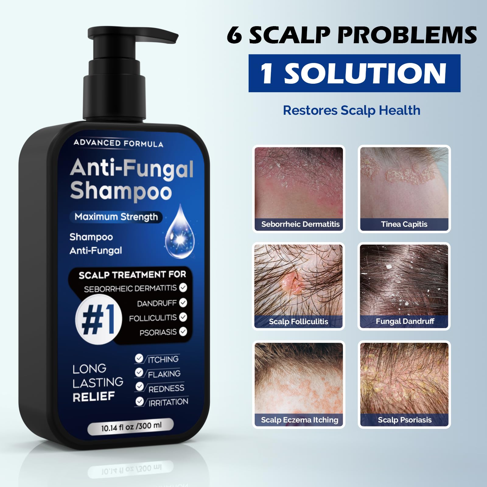 oely antifungal shampoo foaming-lather demonstrates thorough cleansing for irritated scalps
