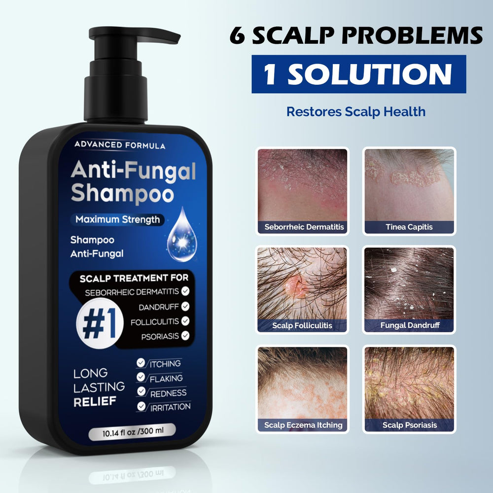 oely antifungal shampoo foaming-lather demonstrates thorough cleansing for irritated scalps