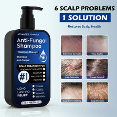 oely antifungal shampoo foaming-lather demonstrates thorough cleansing for irritated scalps