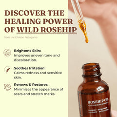 Offernova Rosa Mosqueta oil on skin provides quick absorption and balanced glow.